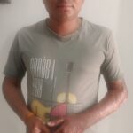 कम्पनी में ही कार्य के दौरान आग से झुलसने पर तथाकथित बड़ी फार्मा कम्पनी ने दरकिनार किया अपना ही कर्मचारी राहुल;